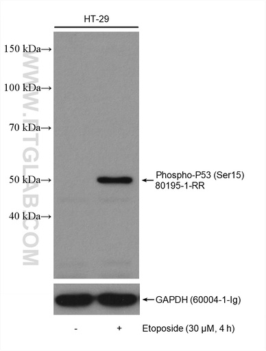 [80195-1-RR-20UL] Phospho-P53 (Ser15) Recombinant antibody