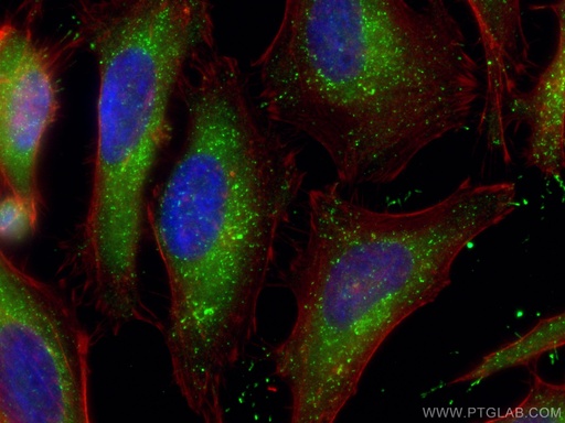 [80196-1-RR-20UL] PEX14 (human specific) Recombinant antibody