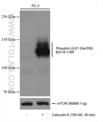 [80218-1-RR-20UL] Phospho-ULK1 (Ser556) Recombinant antibody