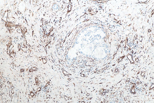 [80232-1-RR-100UL] Vimentin Recombinant antibody