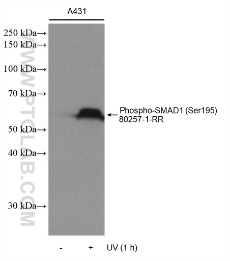 [80257-1-RR-20UL] Phospho-SMAD1 (Ser195) Recombinant antibody