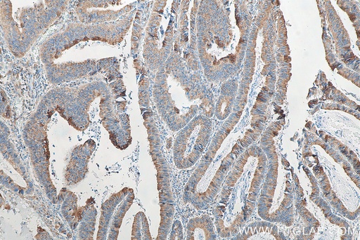 [BIOTIN-10283-100UL] Biotin-conjugated Mouse-IgG Polyclonal antibody