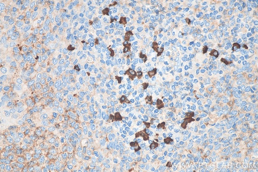 [BIOTIN-11449-100UL] Biotin-conjugated Human IgA Heavy Chain Polyclonal antibody