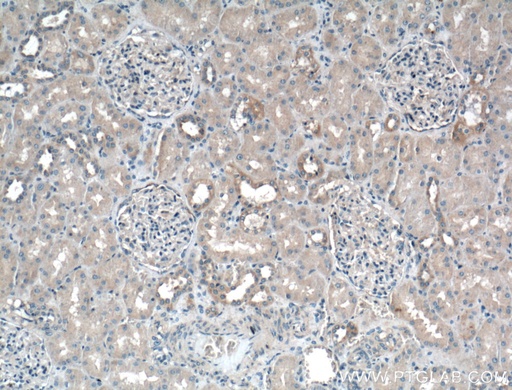 [BIOTIN-18410-100UL] Biotin-conjugated Granulin Polyclonal antibody
