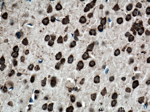 [BIOTIN-21776-100UL] Biotin-conjugated Ataxin 2 Polyclonal antibody