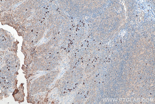[BIOTIN-60099-100UL] Biotin-conjugated Human IgA Monoclonal antibody