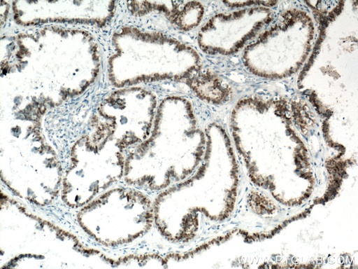 [BIOTIN-60145-100UL] Biotin-conjugated PAX8 Monoclonal antibody