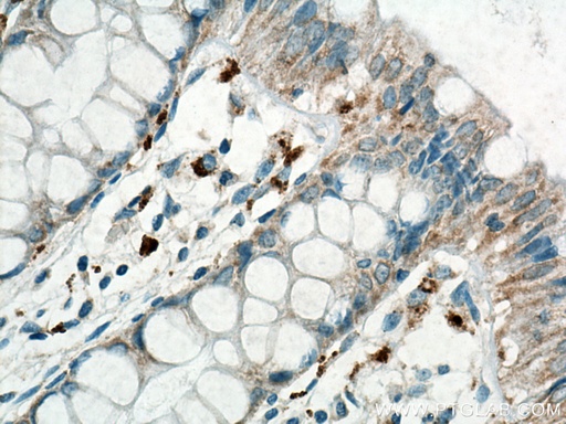 [BIOTIN-65161-100UG] Biotin Anti-Human MICA/MICB (6D4)