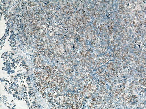 [BIOTIN-66467-100UL] Biotin-conjugated Heavy chain of Rabbit IgG Monoclonal antibody