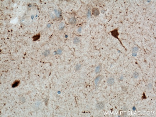 [BIOTIN-66496-100UL] Biotin-conjugated Calretinin Monoclonal antibody