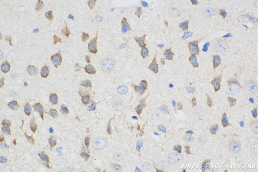 [BIOTIN-67115-100UL] Biotin-conjugated L1CAM Monoclonal antibody