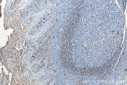 [BIOTIN-67538-100UL] Biotin-conjugated IGHD Monoclonal antibody