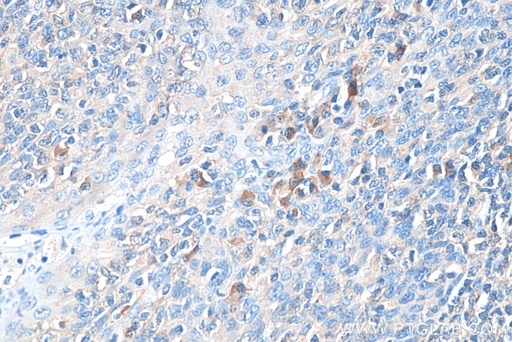 [BIOTIN-67761-100UL] Biotin-conjugated Human IgG Kappa chain Monoclonal antibody