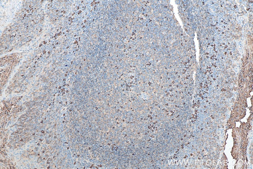 [BIOTIN-67762-100UL] Biotin-conjugated Human IgG lambda chain Monoclonal antibody