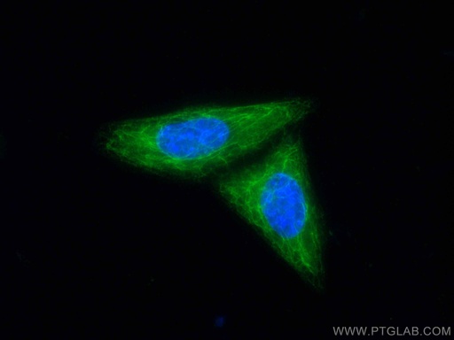 [CL488-10143-100UL] CoraLite®488-conjugated Cytokeratin 14 Polyclonal antibody
