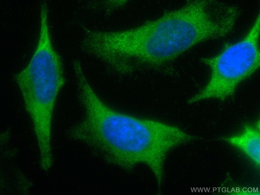 [CL488-10268-100UL] CoraLite®488-conjugated IkB Alpha Polyclonal antibody