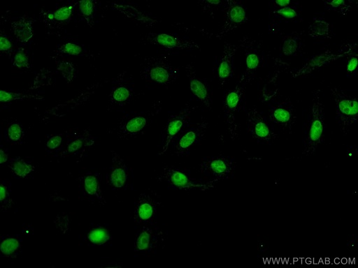 [CL488-10336-100UL] CoraLite®488-conjugated PAX8 Polyclonal antibody