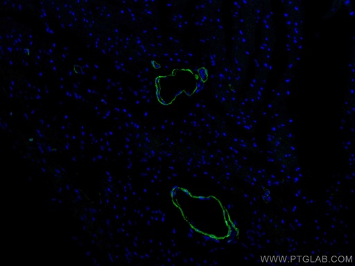 [CL488-10493-100UL] CoraLite®488-conjugated transgelin/SM22 Polyclonal antibody