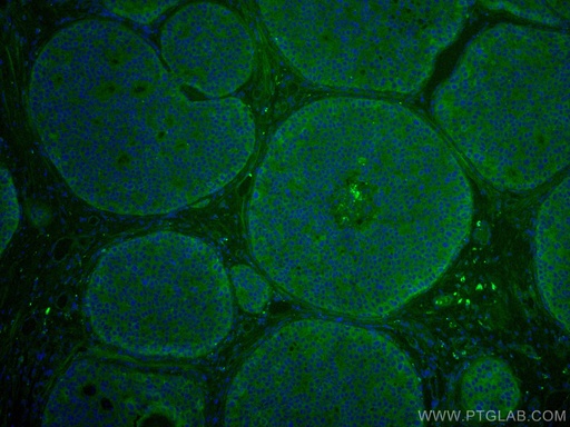 [CL488-10503-100UL] CoraLite®488-conjugated KEAP1 Polyclonal antibody