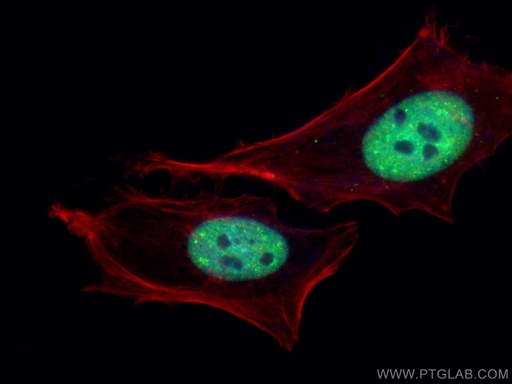 [CL488-10782-100UL] CoraLite®488-conjugated TDP-43 Polyclonal antibody