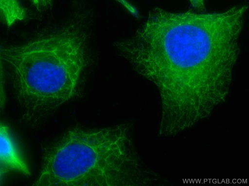 [CL488-10830-100UL] CoraLite®488-conjugated Cytokeratin 18 Polyclonal antibody