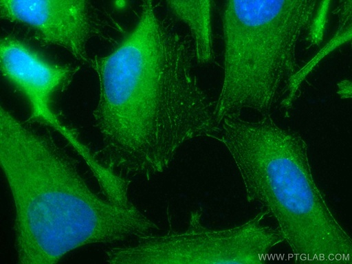 [CL488-10853-100UL] CoraLite®488-conjugated Palladin Polyclonal antibody