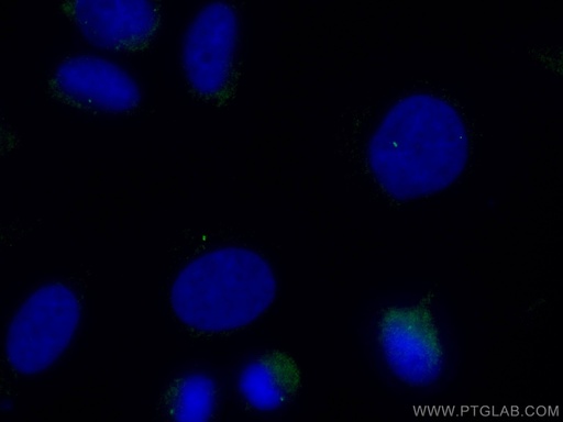 [CL488-11517-100UL] CoraLite®488-conjugated CENPJ Polyclonal antibody