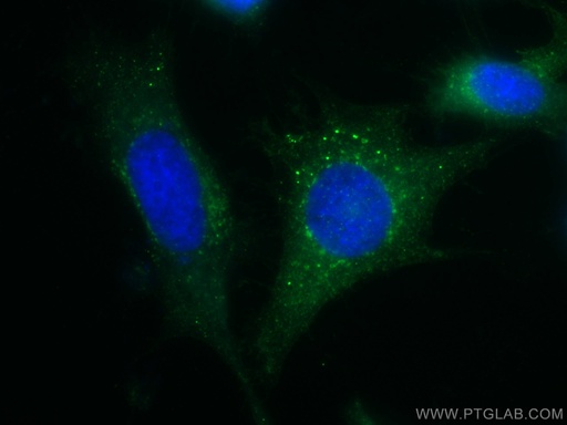 [CL488-11714-100UL] CoraLite®488-conjugated IFITM3 Polyclonal antibody