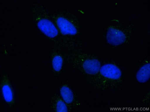 [CL488-11744-100UL] CoraLite®488-conjugated IFT81 Polyclonal antibody