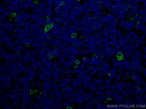 [CL488-12008-100UL] CoraLite®488-conjugated TIMD4 Polyclonal antibody