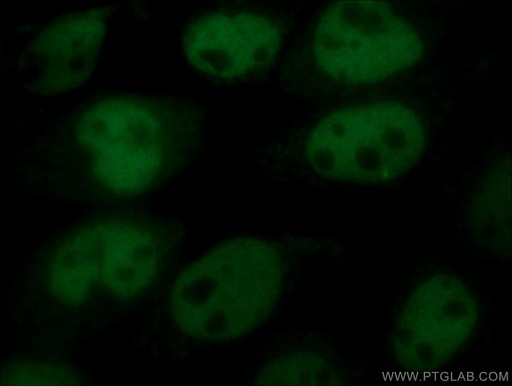 [CL488-12143-100UL] CoraLite®488-conjugated p63 Polyclonal antibody