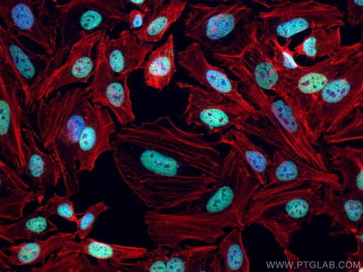 [CL488-12439-100UL] CoraLite®488-conjugated CREST Polyclonal antibody