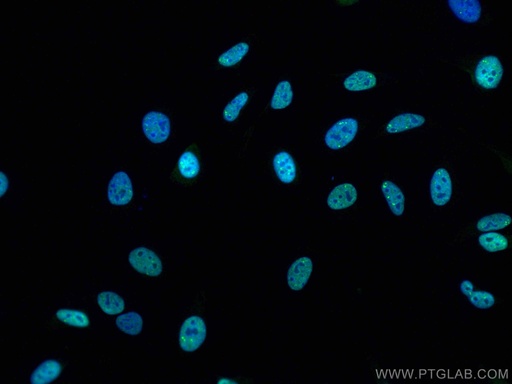 [CL488-12892-100UL] CoraLite®488-conjugated TDP-43 (C-terminal) Polyclonal antibody