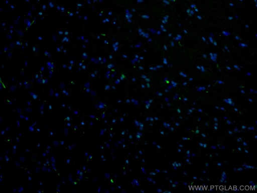 [CL488-13999-100UL] CoraLite®488-conjugated OLIG2 Polyclonal antibody
