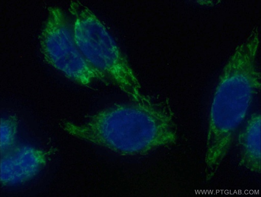 [CL488-14341-100UL] CoraLite®488-conjugated MAVS; VISA Polyclonal antibody