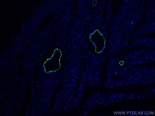 [CL488-14395-100UL] CoraLite®488-conjugated smooth muscle actin Polyclonal antibody
