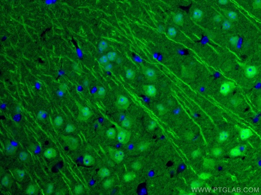 [CL488-14730-100UL] CoraLite®488-conjugated UCHL1/PGP9.5 Polyclonal antibody