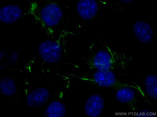 [CL488-15613-100UL] CoraLite®488-conjugated Fibronectin Polyclonal antibody