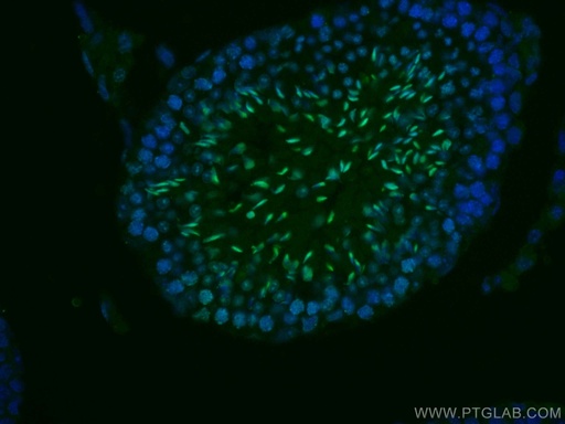 [CL488-17178-100UL] CoraLite®488-conjugated TNP1 Polyclonal antibody