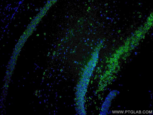 [CL488-17479-100UL] CoraLite®488-conjugated YTHDF1 Polyclonal antibody