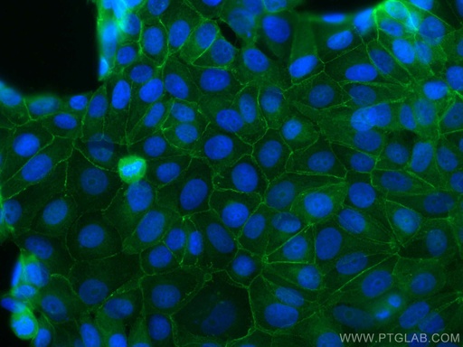 [CL488-17565-100UL] CoraLite®488-conjugated Beta Catenin Polyclonal antibody