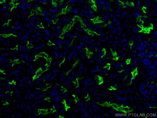 [CL488-18470-100UL] CoraLite®488-conjugated CD133 Polyclonal antibody