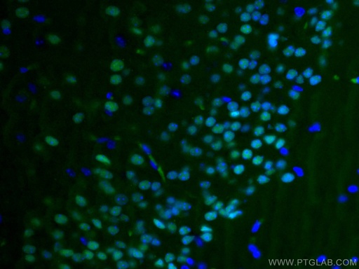 [CL488-20932-100UL] CoraLite®488-conjugated TBR1 Polyclonal antibody
