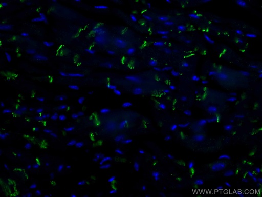 [CL488-22018-100UL] CoraLite®488-conjugated N-cadherin Polyclonal antibody