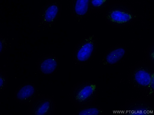 [CL488-22227-100UL] CoraLite®488-conjugated CEP164 Polyclonal antibody