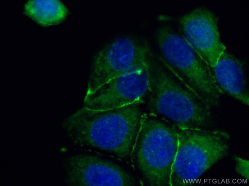 [CL488-51067-100UL] CoraLite®488-conjugated Beta Catenin Polyclonal antibody