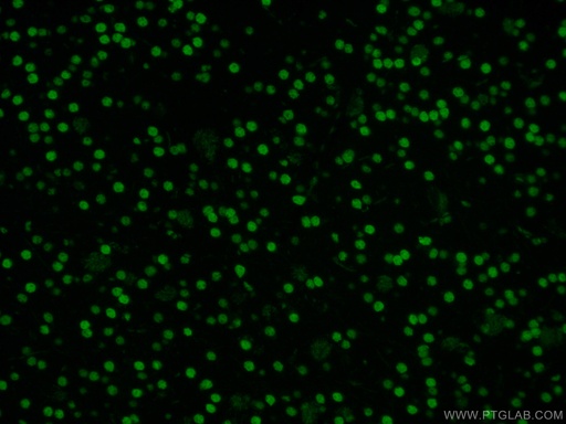 [CL488-60082-100UL] CoraLite®488-conjugated DACH1 Monoclonal antibody