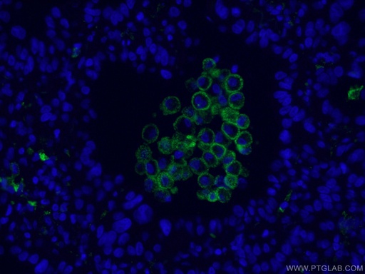 [CL488-60143-100UL] CoraLite®488-conjugated CD206 Monoclonal antibody