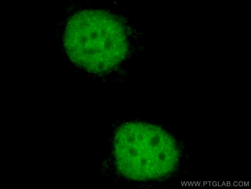 [CL488-60145-100UL] CoraLite®488-conjugated PAX8 Monoclonal antibody