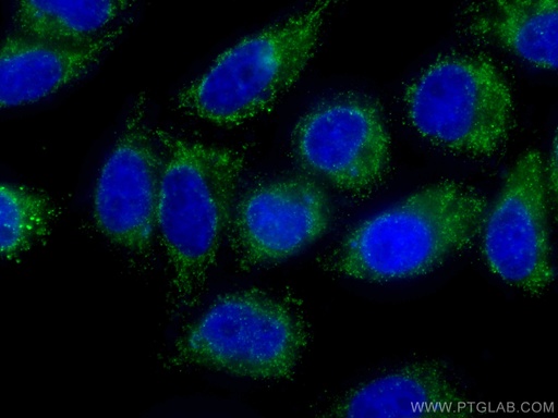 [CL488-60150-100UL] CoraLite®488-conjugated GSTO1 Monoclonal antibody